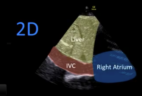 Lecture 3 Ultrasound Modalities OpenAnesthesia