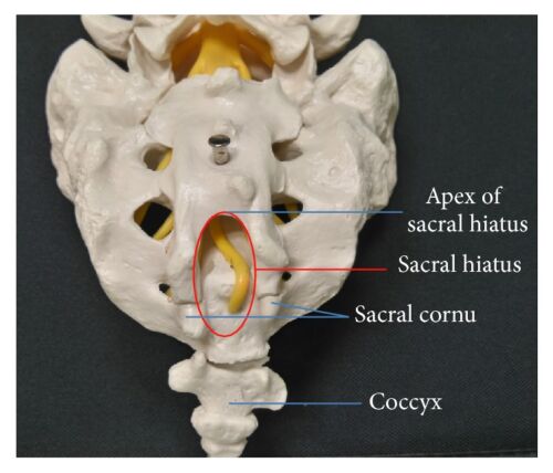 sacral canal contents